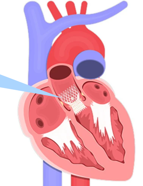 Specialty Image